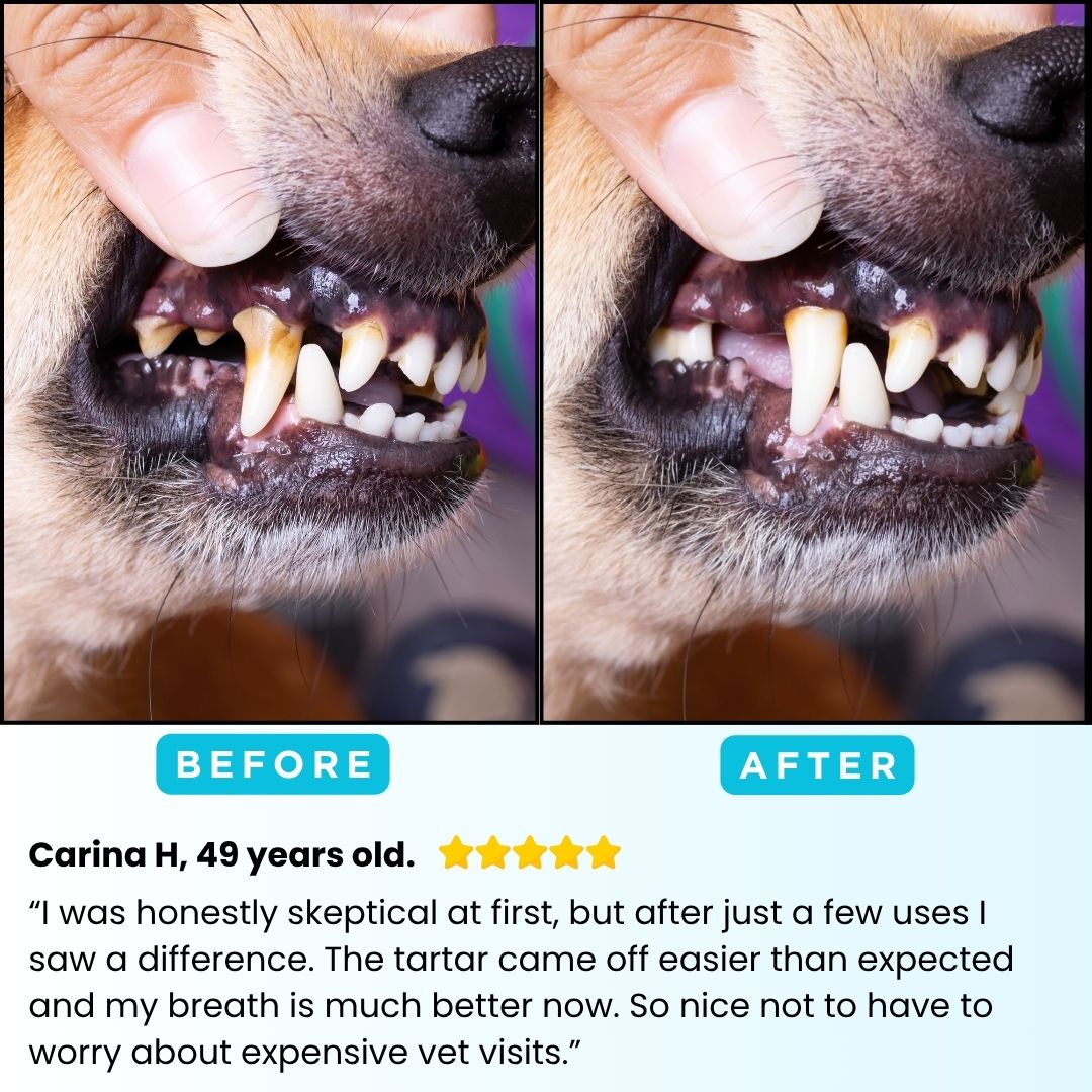 FreshSmile 3 in 1 Kit - Safe Tartar Remover