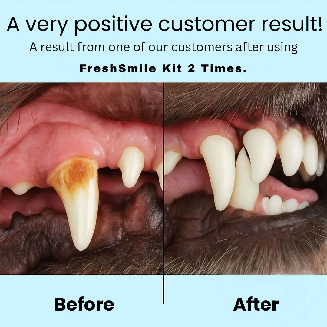 Freshsmile Kit - Safe Dental Care From Home