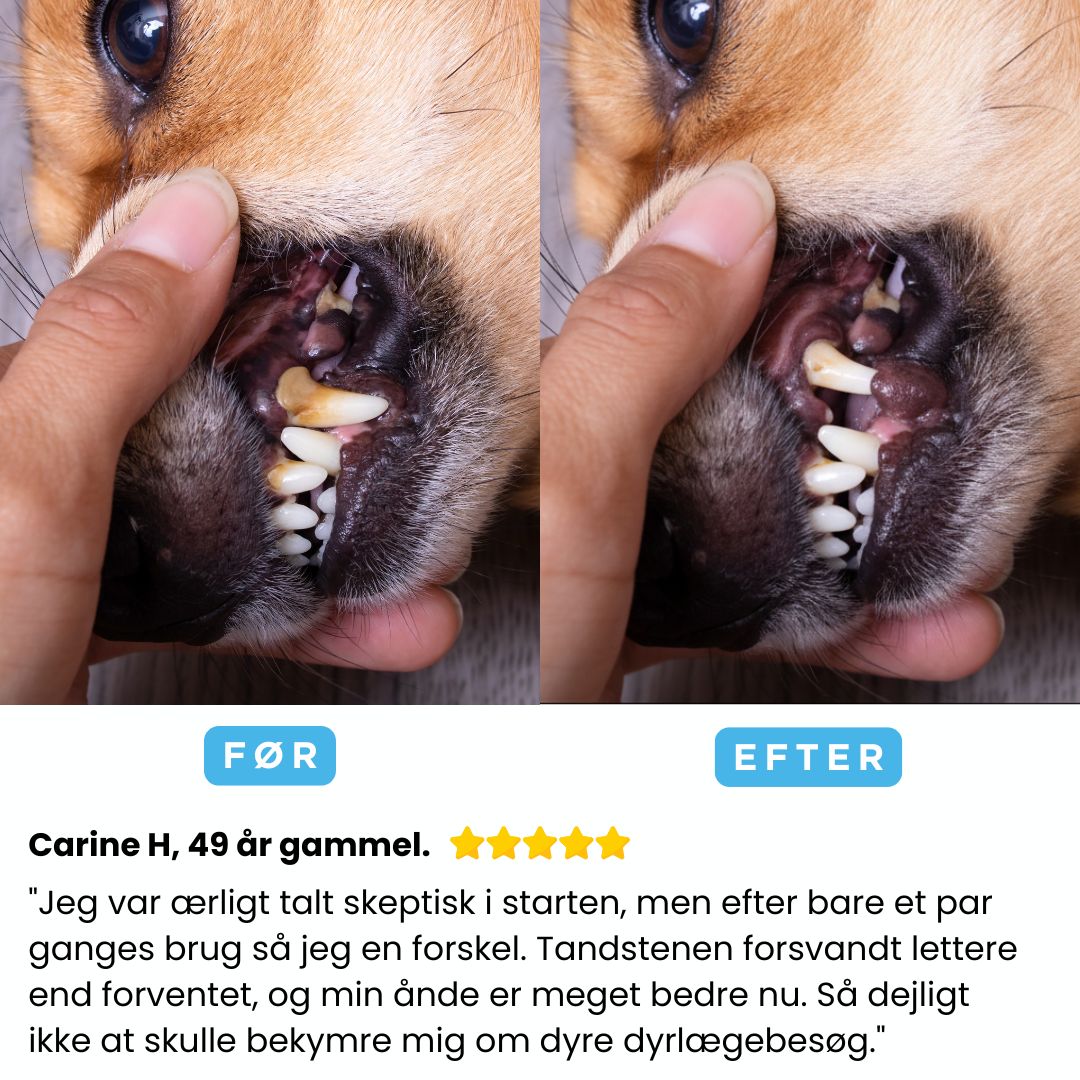 Freshsmile Kit – Tryg Tandpleje Hjemmefra