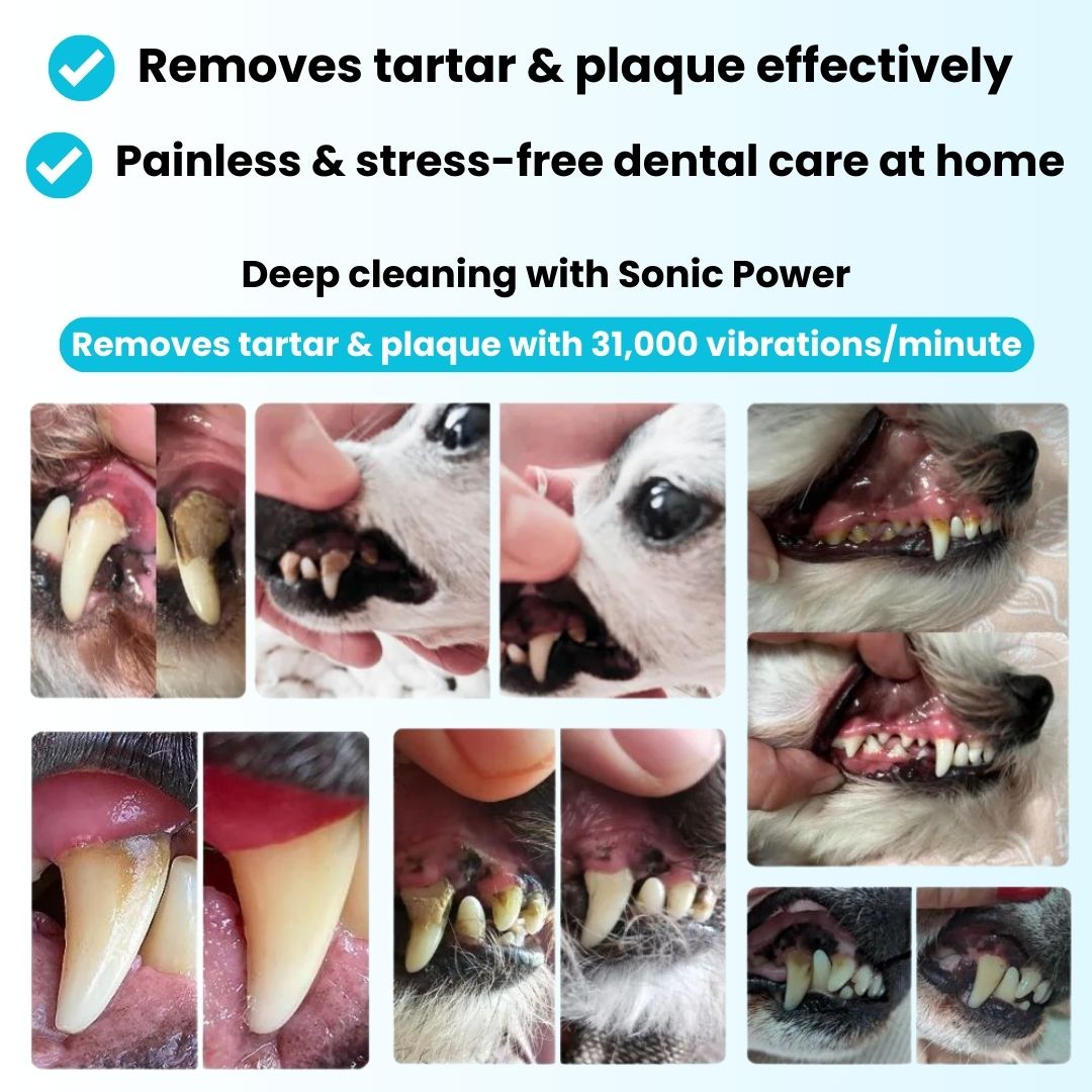 Freshsmile Kit - Safe Dental Care From Home