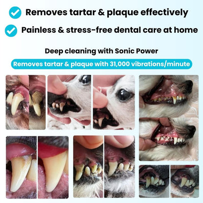 Freshsmile Kit - Safe Dental Care From Home