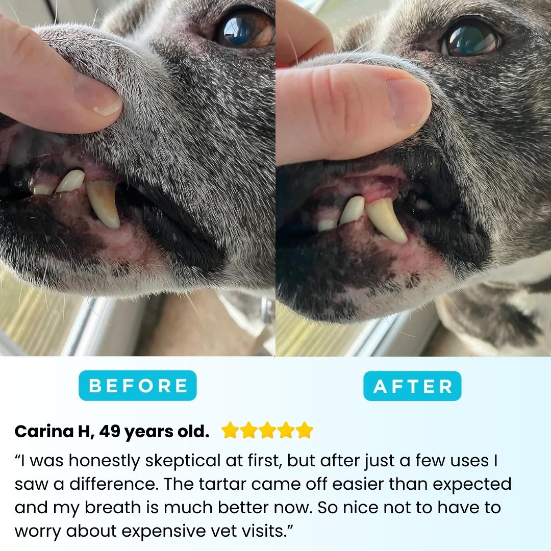 Freshsmile Kit - Safe Dental Care From Home
