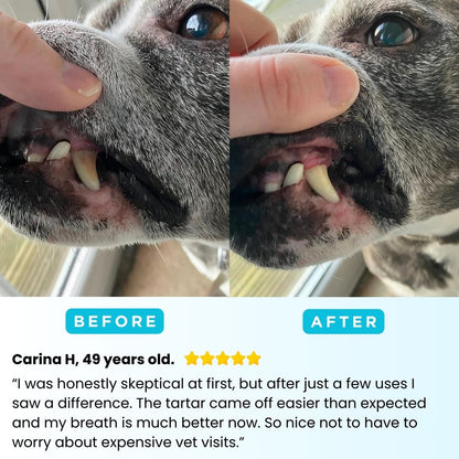 Freshsmile Kit - Safe Dental Care From Home