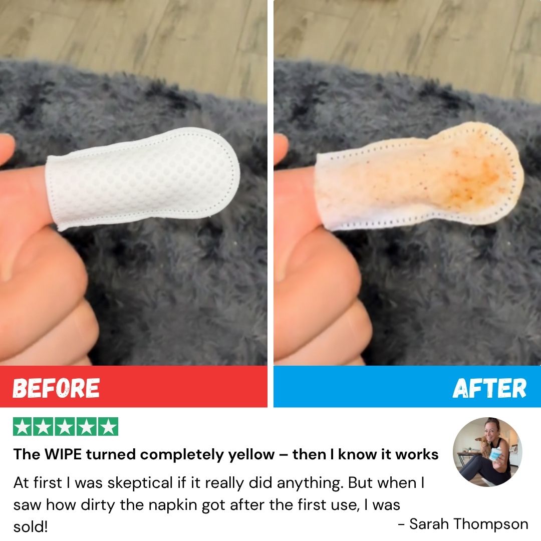 FreshWipes Plaque Relief Kit