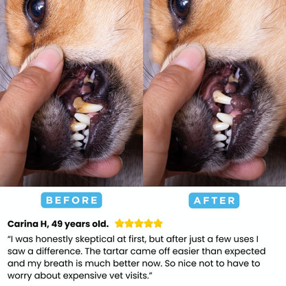 FreshSmile 3 in 1 Kit - Safe Tartar Remover